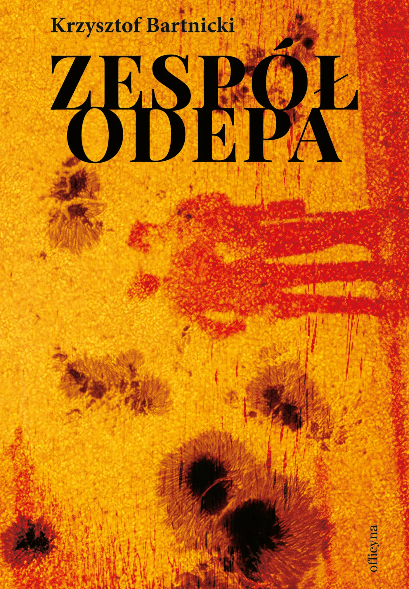 Zespół Odepa